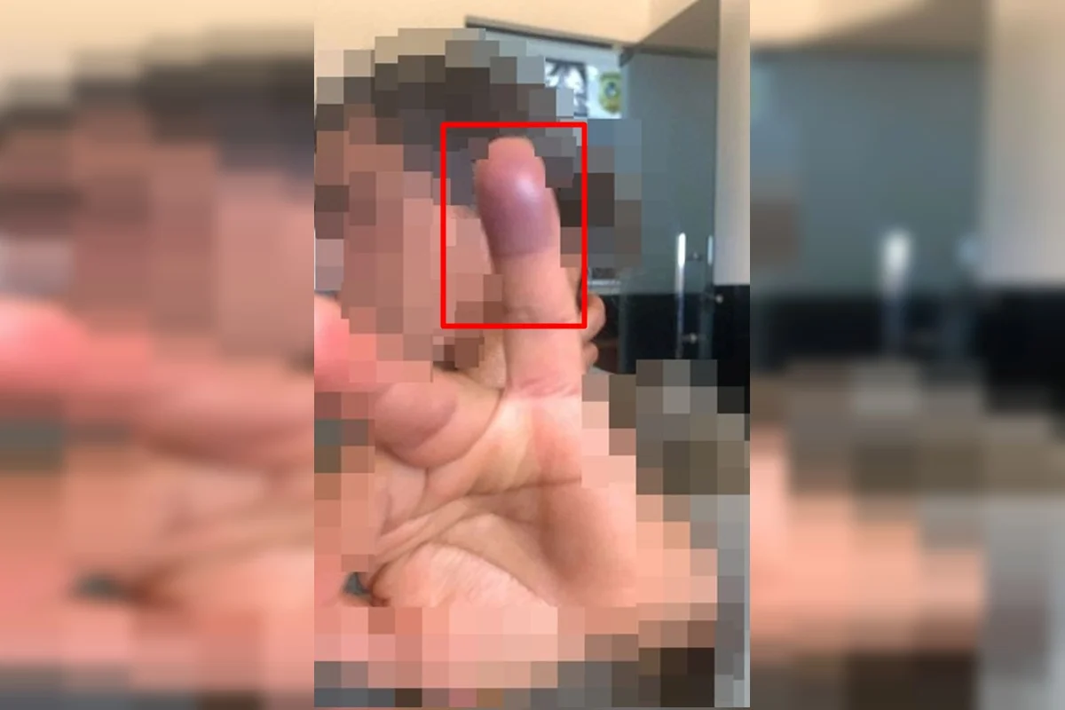 Veja como ficou mulher atacada por desconhecido que invadiu residência em Cristalina
